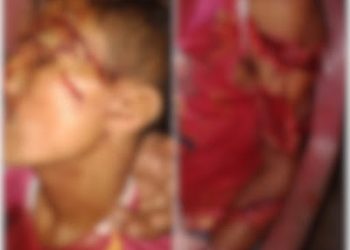 JOVEM SOFRE TENTATIVA DE HOMICÍDIO A GOLPES DE FACÃO EM NINA RODRIGUES.