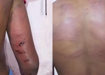 Policial suspeito por tortura de adolescente no MA é preso preventivamente