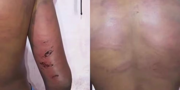 Policial suspeito por tortura de adolescente no MA é preso preventivamente