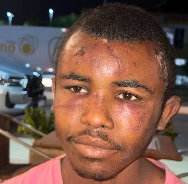 EXECUÇÃO OU EMBOSCADA? MISTÉRIO CERCA MORTE DE ‘MARQUINHOS EM PRESIDENTE VARGAS.